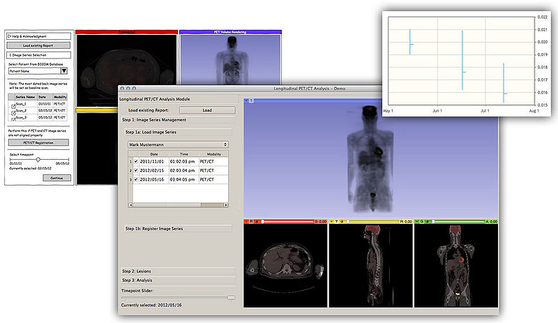File:Long PETCT Progress.jpg