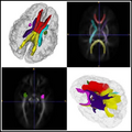Thumbnail for version as of 18:13, 29 July 2011