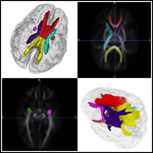 Wang-NeuroImage2011-fig2.png