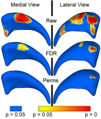 UNCShape CaudatePval MICCAI06.png