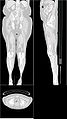 Ct-body-legs.jpg