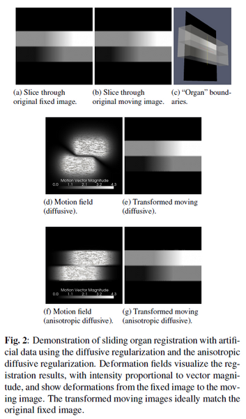 File:SlidingOrganRegistration artificial.png
