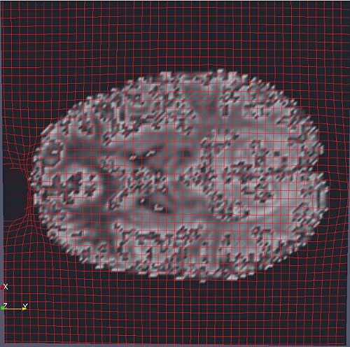 OMT Deformation Grid