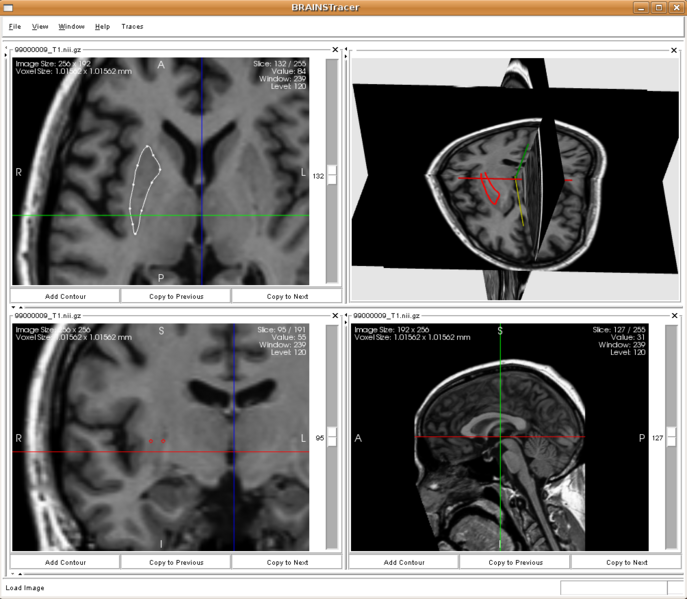 File:BRAINSTracer1.png