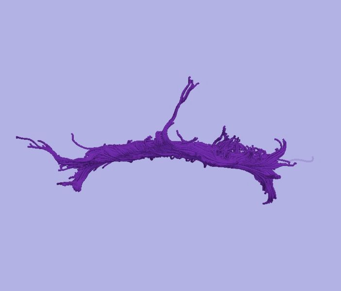 File:CaseD00724 L dil9 sens1.jpg