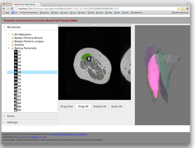 File:Chronicle-muscles 1-2014-05-22.png