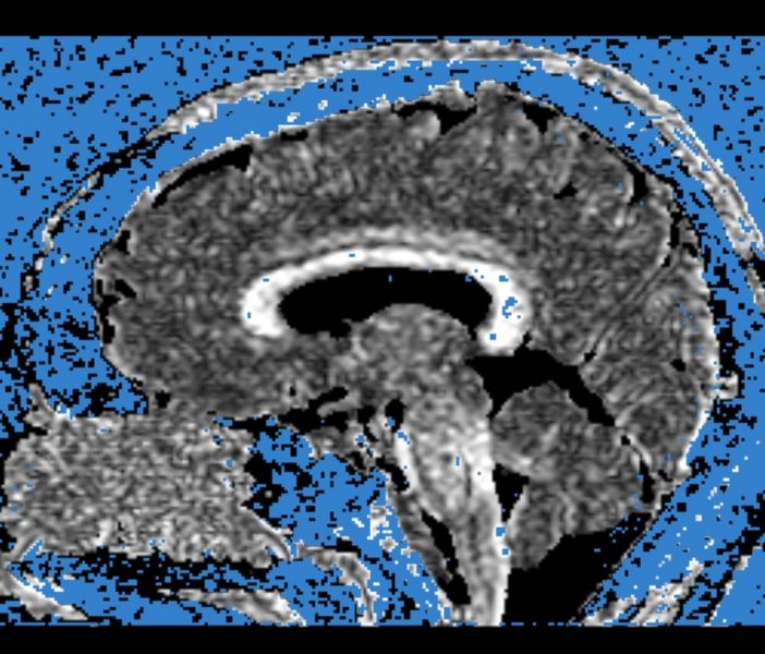 File:CaseD00724 A3.jpg