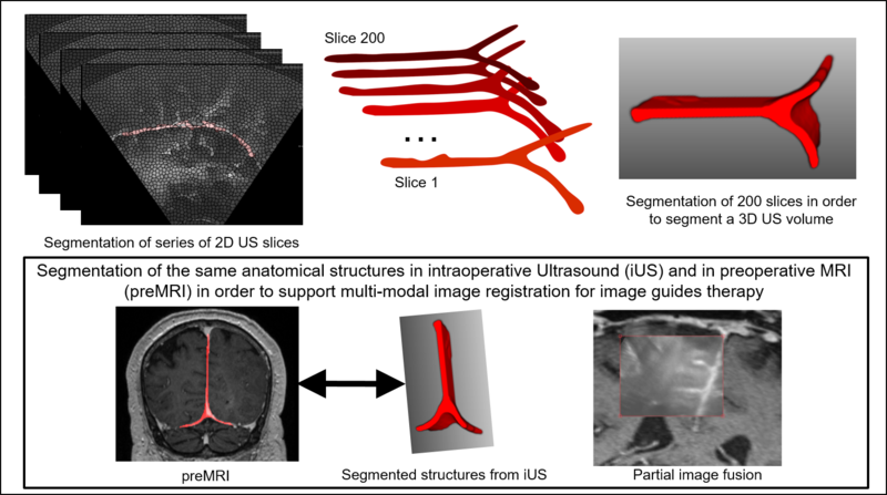 File:MultimodalImageSegmentation2.png