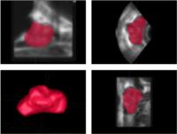 Prostate20080318 seg.png