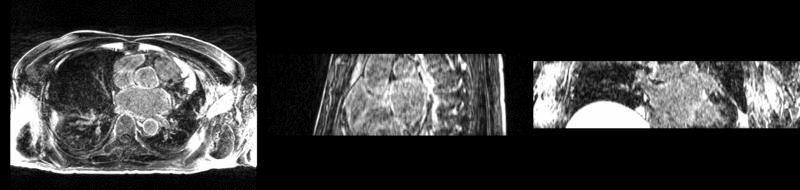 File:Rview after.gif