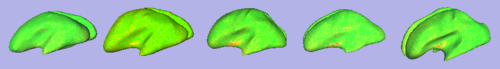 Cortical thickness overlayed on inflated cortical surfaces