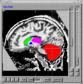 Thumbnail for version as of 00:31, 22 October 2007