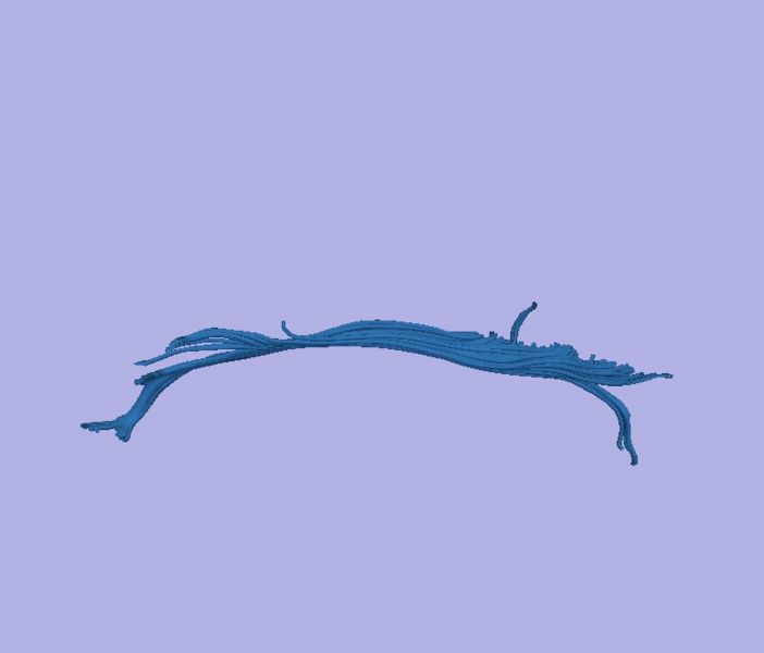 File:CaseD00724 L dil0 sens80.jpg