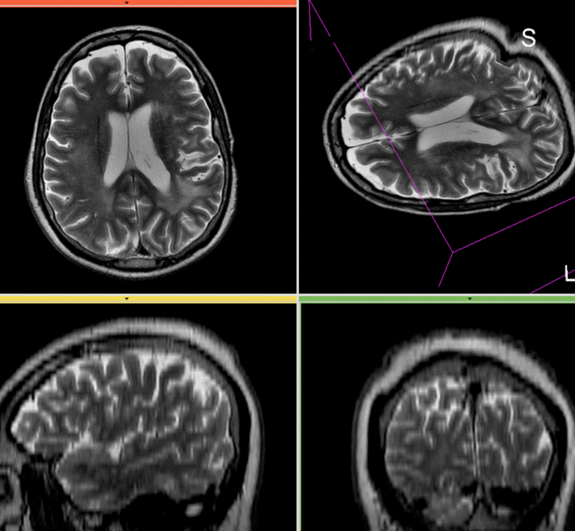 File:RegLib C03 AffineResult AnimGif.gif