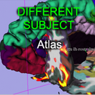 Registration HLogo Atlas.png