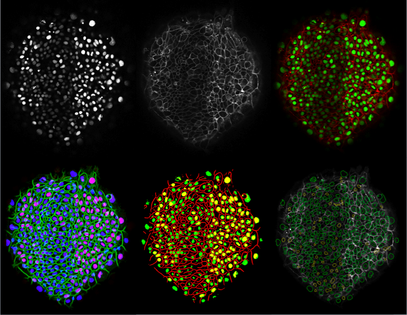 ITK GPAC level set NAMIC Wiki