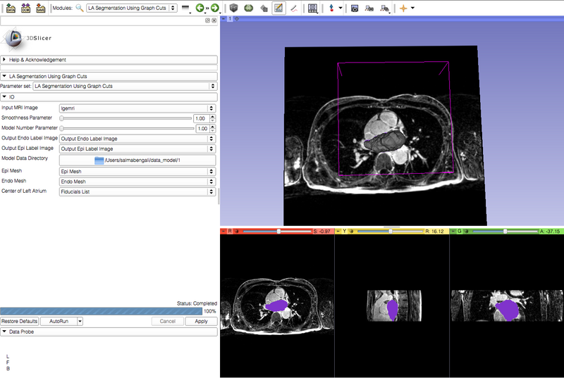 File:CMRToolkit GraphCut.png