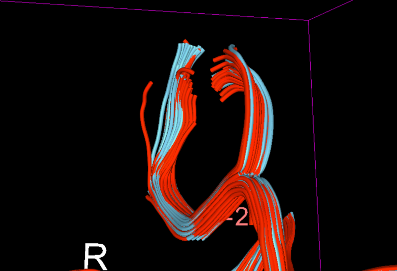 File:Chronic redorig blueQC.png