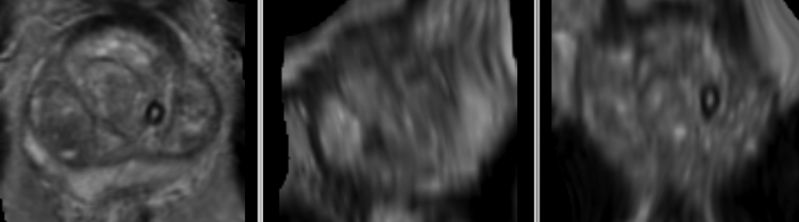 File:RegLib C07 registered Xf3.gif