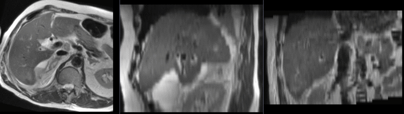 File:RegLib C13 MRT2-CT Affine.gif