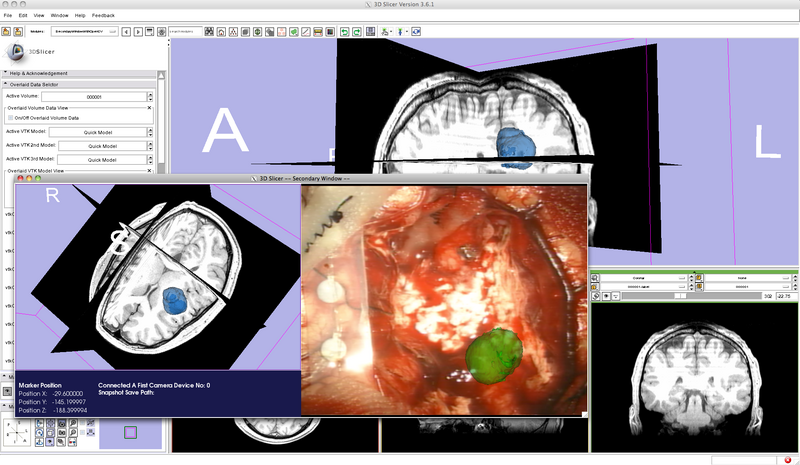 File:Secondary Window with OpenCV2.png