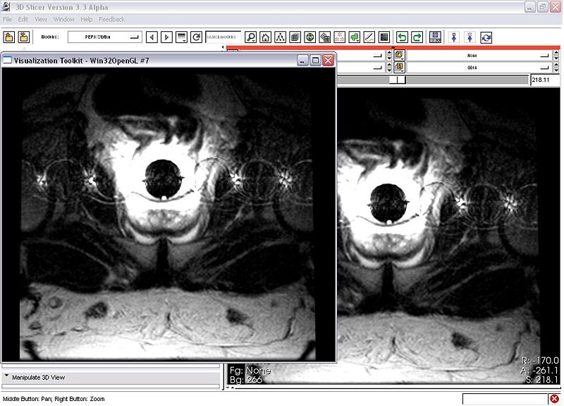 File:PerkStationNAMIC SecondWindow.JPG