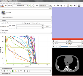 Dose volume histogram in Slicer