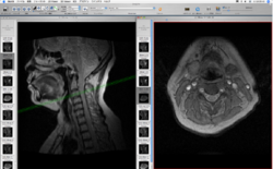 Osirix with thumbnails.png