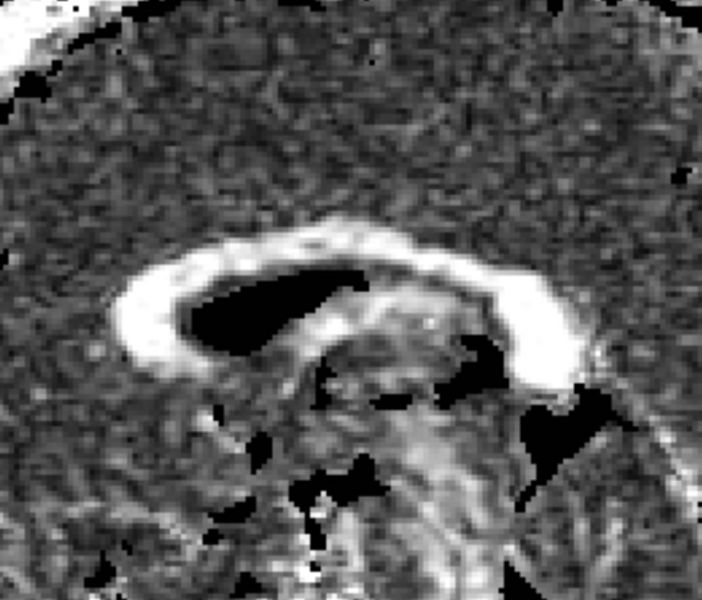 File:CaseD5 corpus0001.jpg