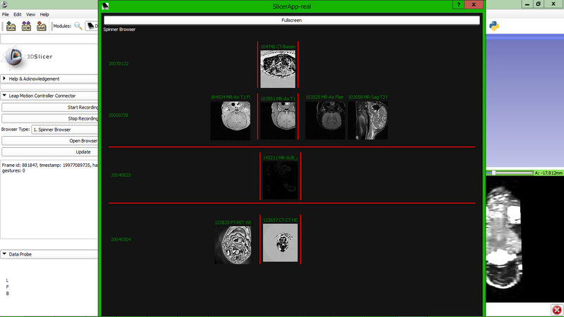 File:DicomExplorerScreenshot 1.png