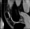 RegLib 05: Knee MRI subject 1