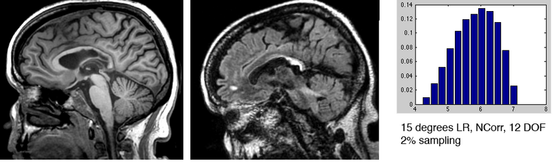 File:SRegTest FLAIR-T1 LRRot15.png