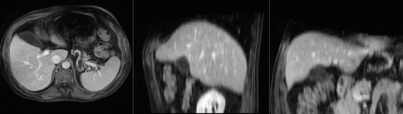 File:RegLib C12 BSpline.gif