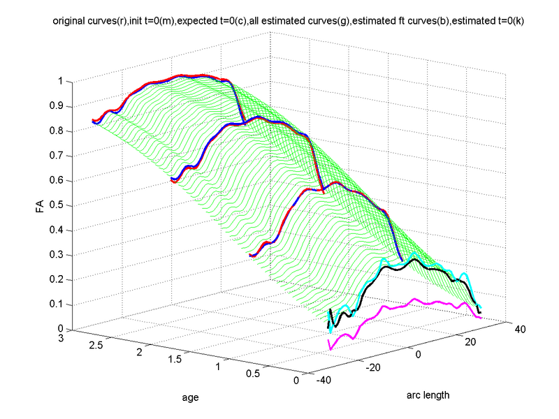 File:Namic tract longitudinal main.png