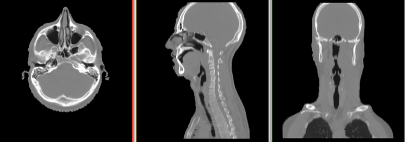 File:RegLib C36 Thumb2.png