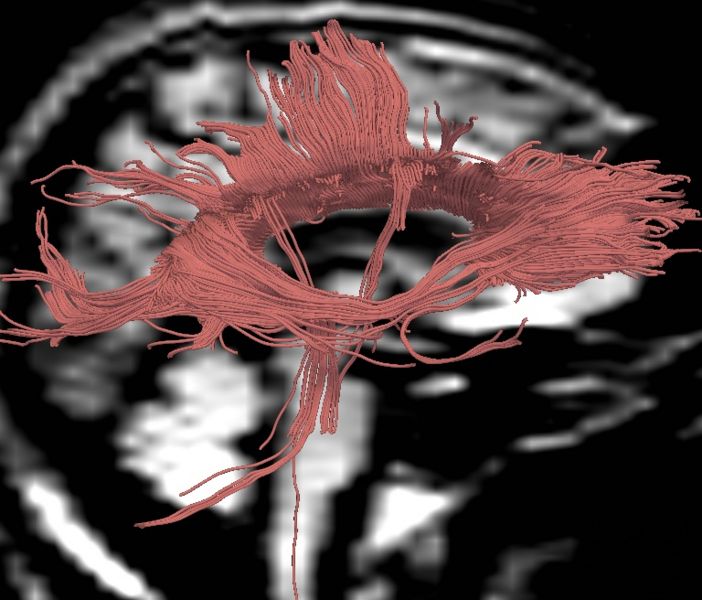 File:CaseD00724 R blur05.jpg