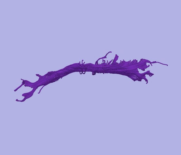 File:CaseD116 L dil5 sens40.jpg