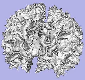 White Matter of the Brain