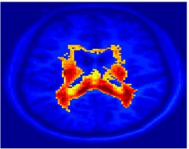 Mit fmri clustering SC 5Clust 5.jpeg