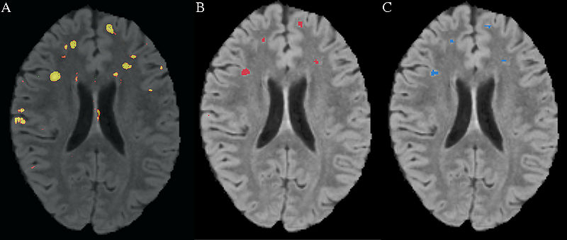 File:Scully Figure3.jpg