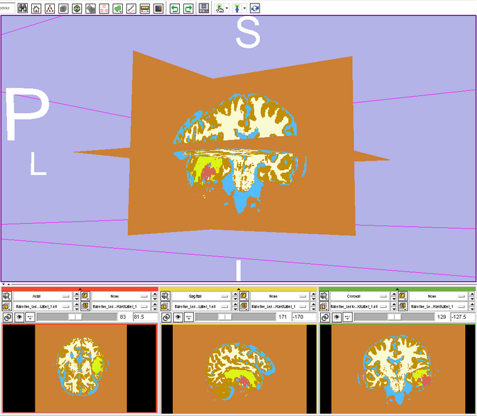 File:TBI Seg lable Slicer.png