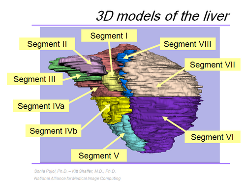 RSNA2009 AnatomyCourse SPujol1.PNG