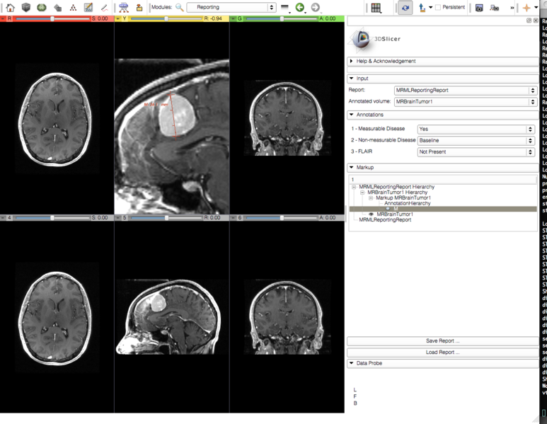 File:Slicer4 Reporting GUI.png