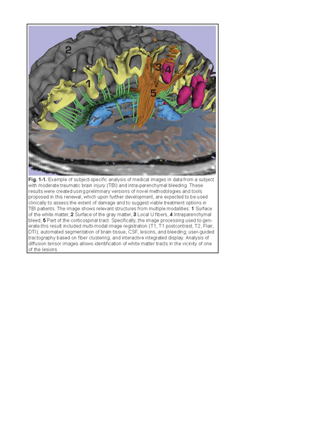 File:TBI Fig.1.final composite.png