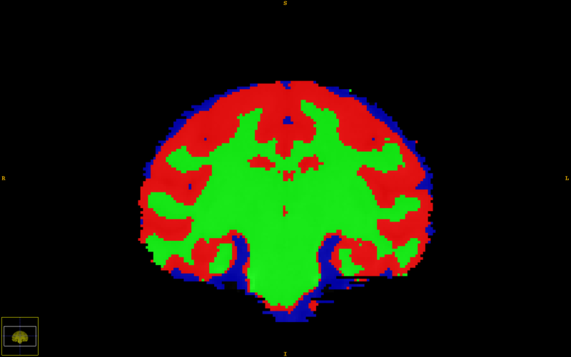 File:Vervet CorScrnShot.jpg