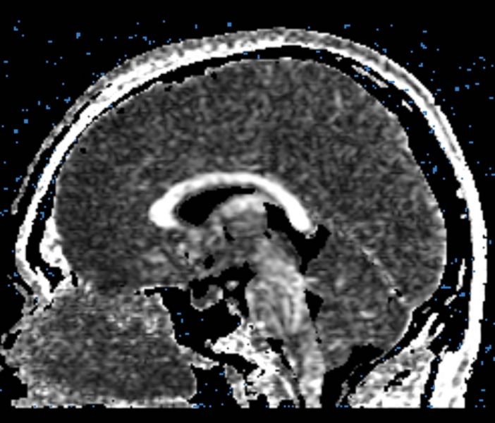 File:CaseD100 B2.jpg