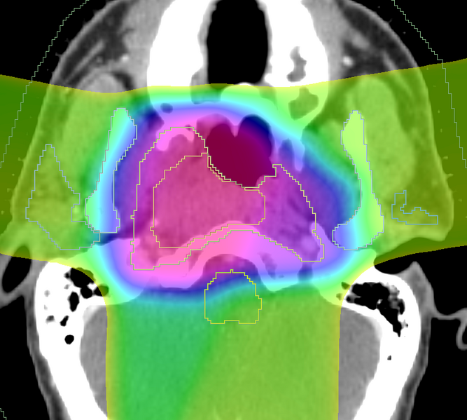 File:DBP3-MGH ss dose.png