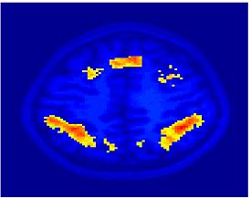 Mit fmri clustering KM 5Clust 2.jpeg