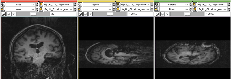 File:RegLib C14 PET-MRI MRIraw.png