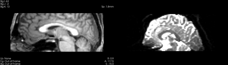 File:Anna t1-baseline demons.png